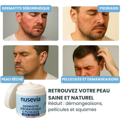 Crème Nusevia | Peau & cuir chevelu apaisés
